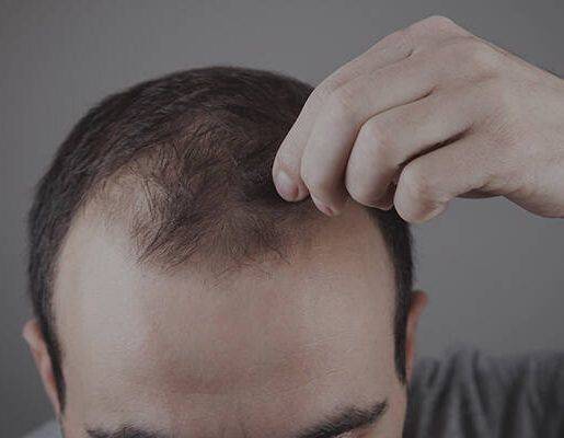 Champú anticaída con activos naturales