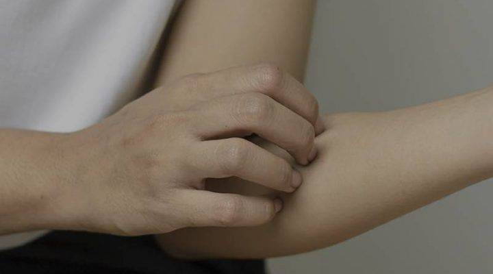 Dermatitis atópica: qué es, causas y recomendaciones