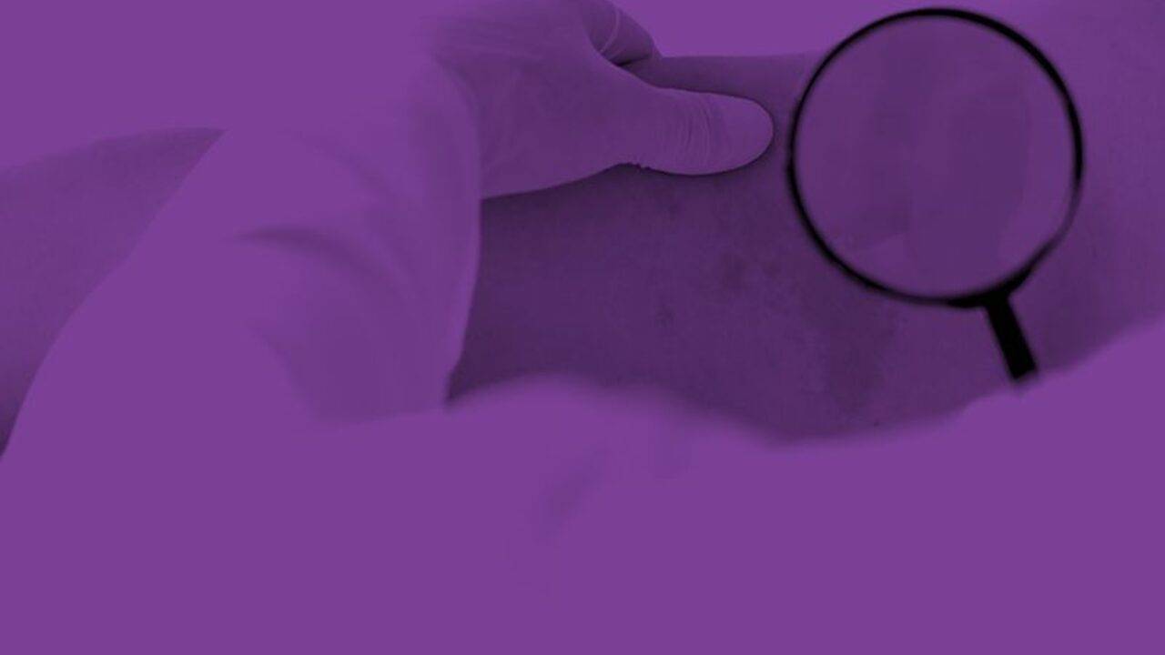 Imiquimod Precios De Remedios