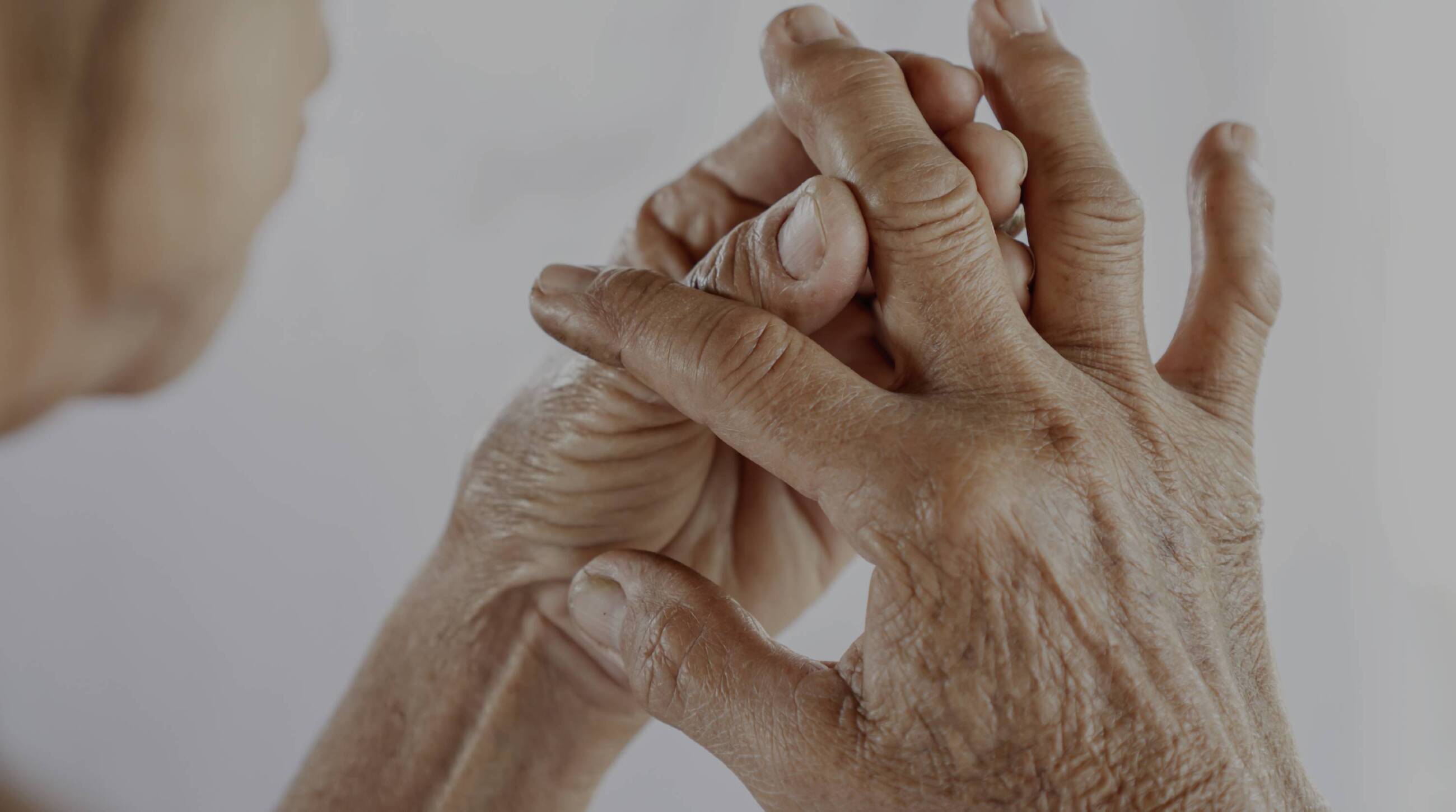 Cuál es la diferencia entre artritis y artrosis?